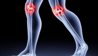 Präventioun vun der Entwécklung vu Arthritis an Arthrosis