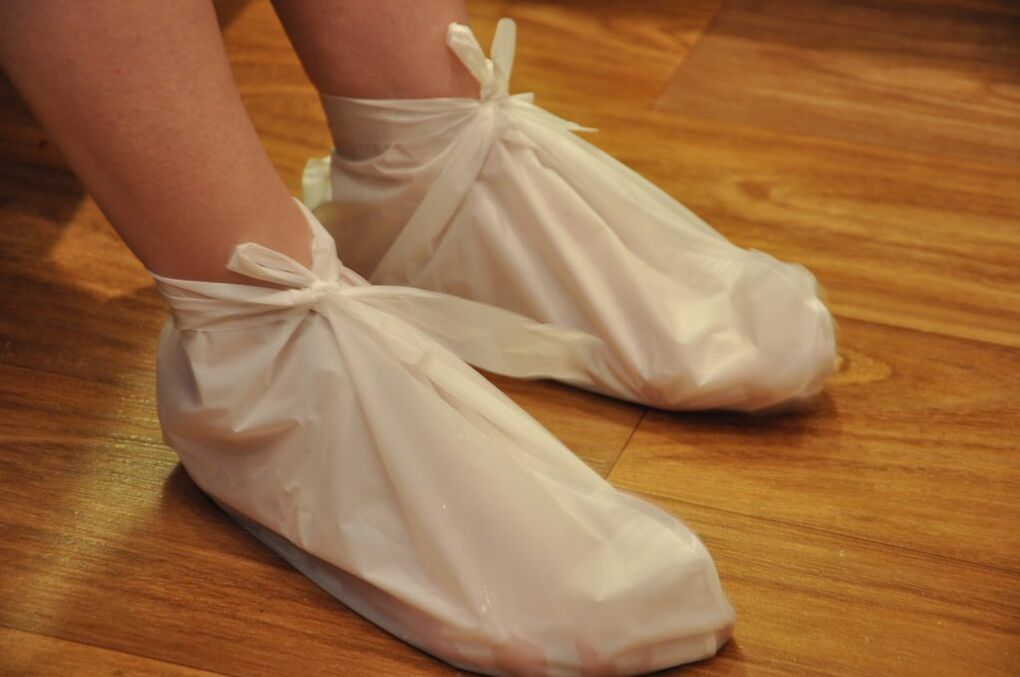 Kompresser fir Knöchelarthrose