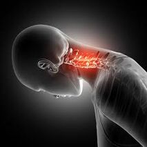 Zervikal Osteochondrose