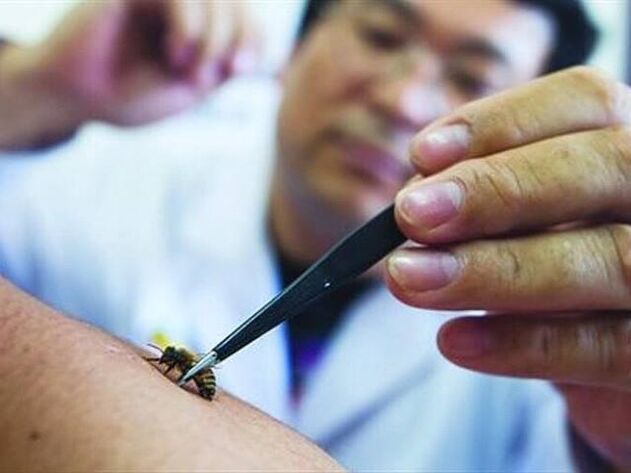 Apitherapie fir zervikal Osteochondrose